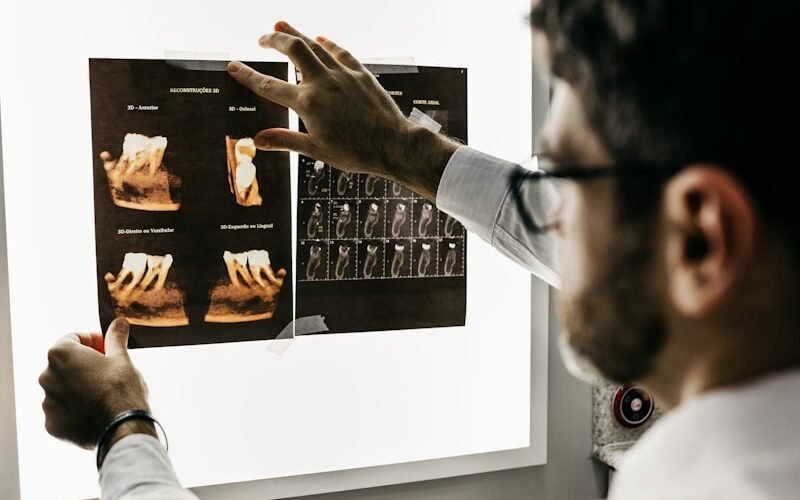 Inteligência artificial já auxilia diagnóstico por imagem em odontologia